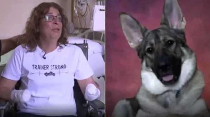 Une infection due à son chien a causé l'amputation des mains et des pieds de Marie Trainer.